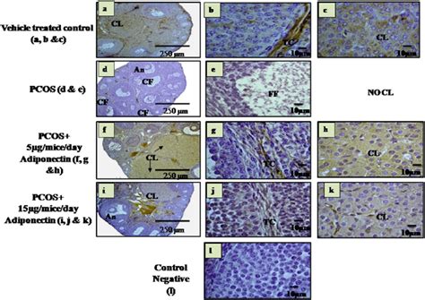 Immunohistochemical Localization Of Adipor1 In The Ovaries Of