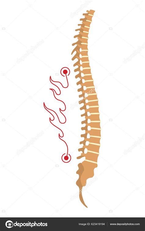 Spinal Deformity Symbol Spine Curvatures Unhealthy Backbones Human