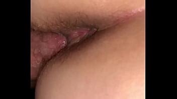 Vista Posterior Con Jeringa XVIDEOS