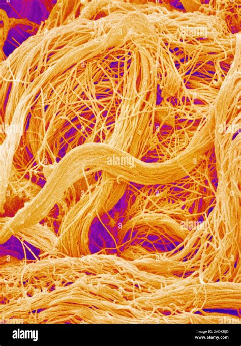 Collagen fibres. Coloured scanning electron micrograph (SEM) of ...