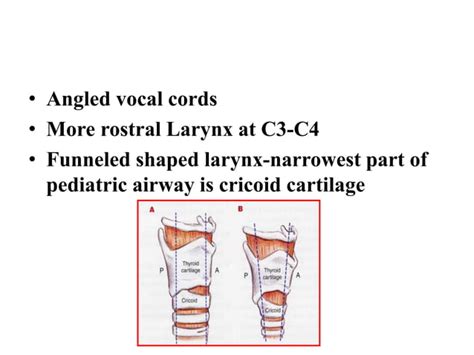 Airway Assessment In Paediatrics Patients Laryngoscopy Intubation Ppt