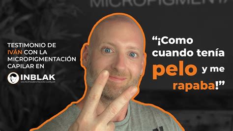 Iván Testimonio de micropigmentación capilar en INBLAK YouTube