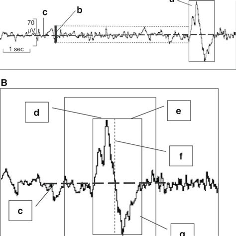 Typical K-complex with subsequent sleep spindle. | Download Scientific Diagram