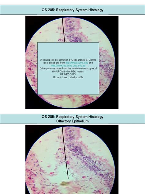 Histology Respiratory | Respiratory System | Lung