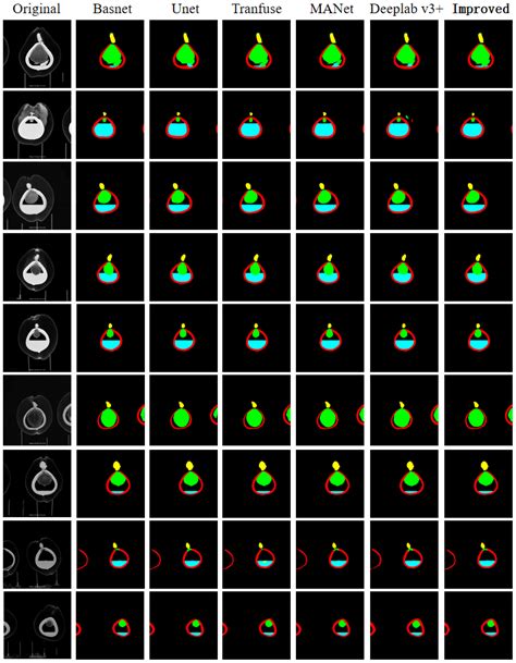 Frontiers An Improved Deeplab V Network Based Coconut Ct Image