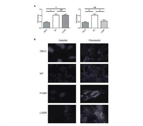 Differences In Mrna Fibronectin Expression For P R And L R Pvhl