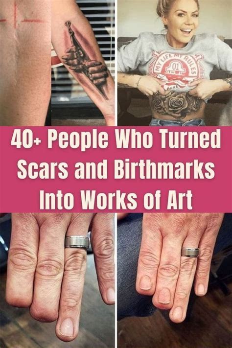 Tattoo Artists Who Turned Scars And Birthmarks Into Works Of Art Artofit