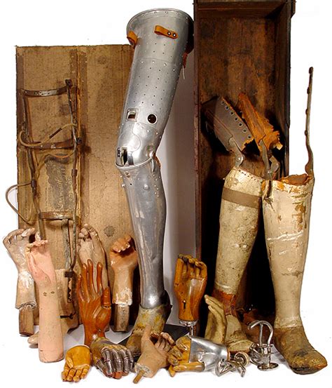 The Brief History of Prosthetic Medicine | www.historynotes.info