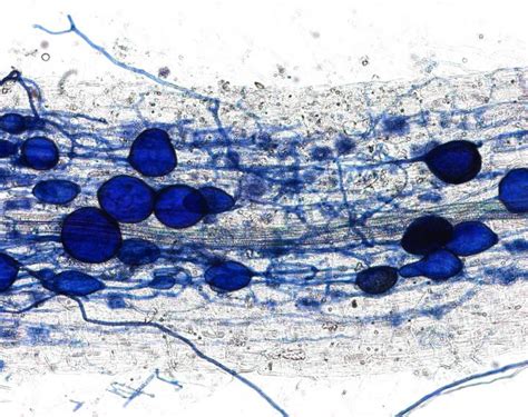 Infected Roots [image] Eurekalert Science News Releases