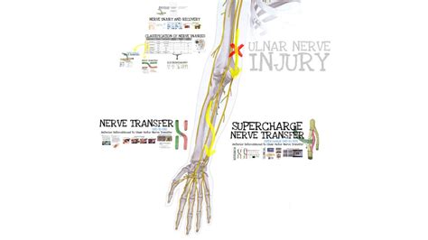 Nerve Transfer Surgical Education Learn Surgery Washington