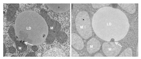 Perspectives On Mitochondriaer And Mitochondrialipid Droplet Contact