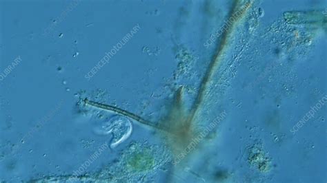 Ciliate Protozoan Light Microscopy Stock Video Clip K