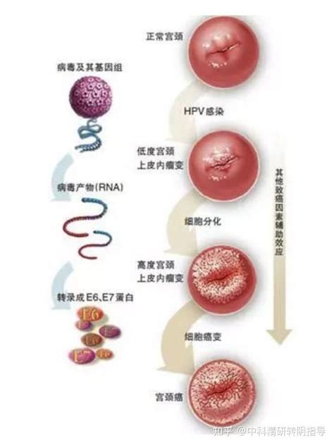 Hpv E6e7mrna是检测什么？阳性怎么办？ 知乎