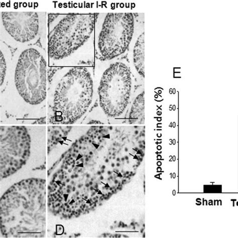 Representative Photos Of Tunel Staining In Testis Of Sham Operated And