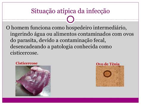 Qual A Diferença Entre Teniase E Cisticercose - FDPLEARN