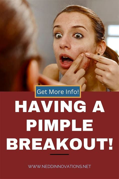 How To Get Rid Of Adult Acne Artofit