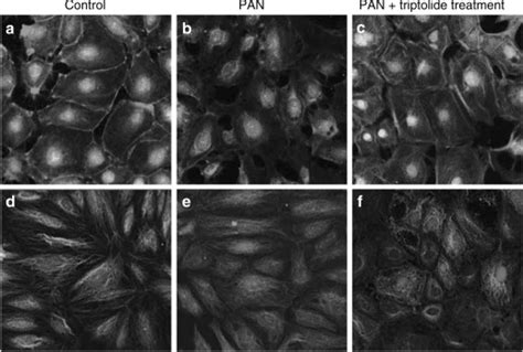 Triptolide Protects Podocytes From Puromycin Aminonucleoside Induced