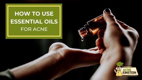 How To Use Essential Oils For Acne