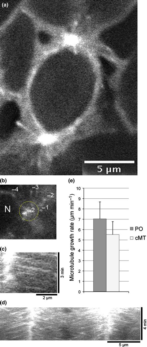 The End Binding Eb Microtubule Marker Revealed The Dynamics Of