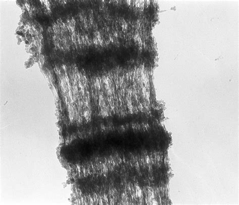 Drosophila Melanogaster Polytene Chromosome Cil Doccheck