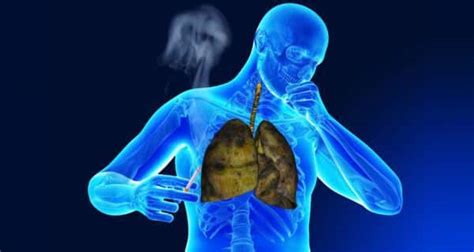 Causes of chest congestion and remedies | TheHealthSite.com