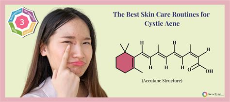 Best Acne Skin Care Routine Developed and Customized by Dermatologists ...