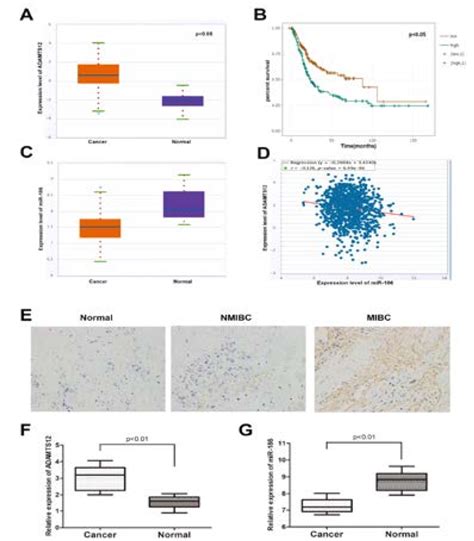 The Correlation Between MiR 186 And ADAMTS12 In BCa Samples A