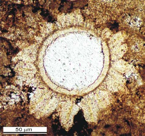 Thin Section Photomicrograph Of A Typical Late Devonian Radiosphaerid