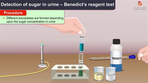 Benedicts Test For Reducing Sugars Principle Composition Usmle