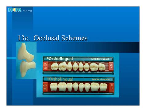 Complete Dentures 16occlusal Schemes Lingualized Occlusion Ppt