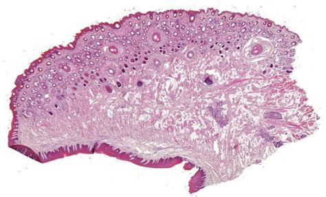Labia Diagram | Quizlet
