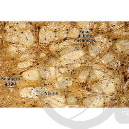 Mammifero Midollo Spinale Sezione Trasversale X Midollo Spinale