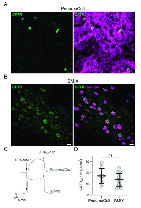 Effect Of Culture Medium On Cftr Expression Pattern Ab Detection Of Download Scientific