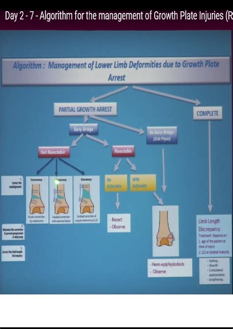 Algorithm For The Management Of Growth Plate Injuries