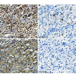 Histopathological Results In The Intracranial Lesion Tissue A