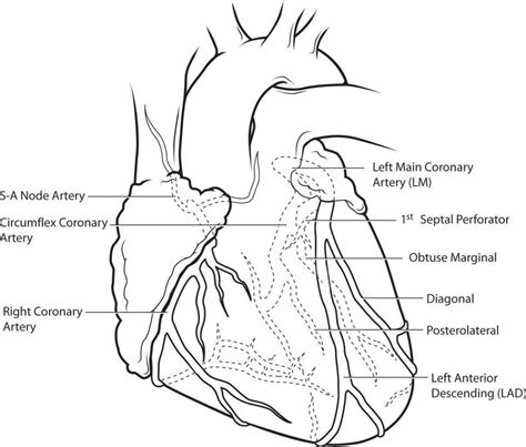 Cardiothoracic Surgery Diseases Of The Heart Great Vessels And