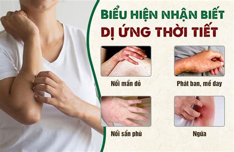 Cách đối phó với biểu hiện dị ứng thời tiết hiệu quả