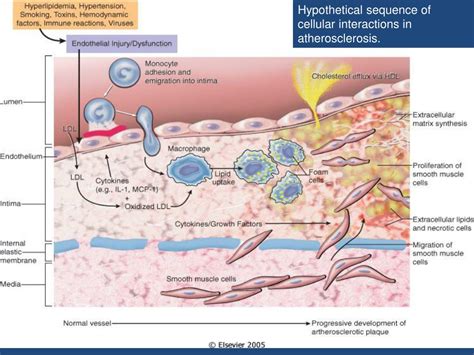 Ppt Atherosclerosis Cvs Lecture 2 Atherosclerosis Powerpoint Presentation Id 2135750