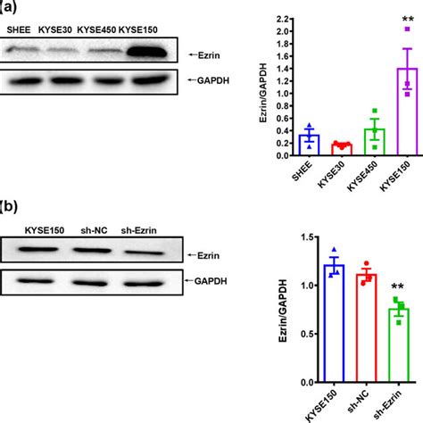 A Ezrin Protein Expression In Esophageal Epithelial Cells And