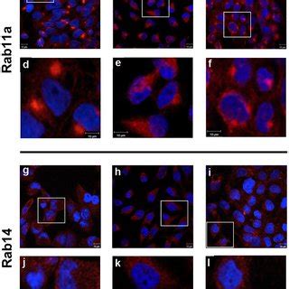 Comparative Localization Patterns Of Rab And Rcp In Human Cell Lines