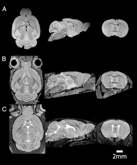 High Resolution Mouse Brain Images Acquired A Ex Vivo Extracted From