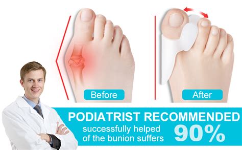 Bunion Corrector For Women Men 12pcs Toe Separator For