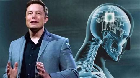 Musk Anuncia Implantação De 1º Chip Cerebral Em Humanos