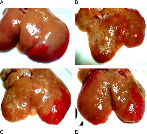 Figure From Transforming Growth Factor Neutralization Ameliorates