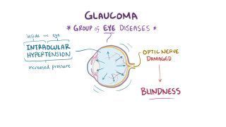 Conjunctival Injection: What Is It, Causes, Diagnosis, and More | Osmosis