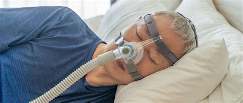 Sleep Apnea Va Rating A Comprehensive Guide For Veterans Trajector