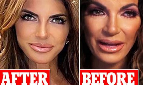 Teresa Giudice Admits She Got A Nose Job By The Same Doctor Who Fixed