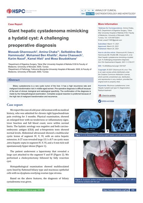 Pdf Giant Hepatic Cystadenoma Mimicking A Hydatid Cyst A Challenging