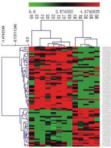 Clustering For GBM And Normal SAGE Libraries N Represents Normal