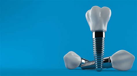 Dental Implants In Lutz Fl Perfect Smile Dental Studio